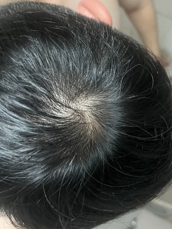 After