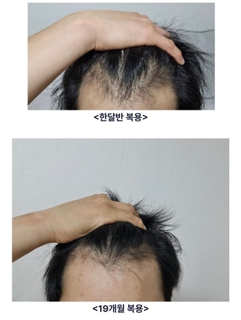 전