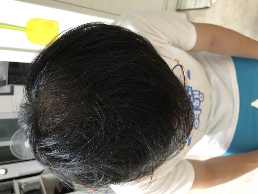 모나페시아 1년
