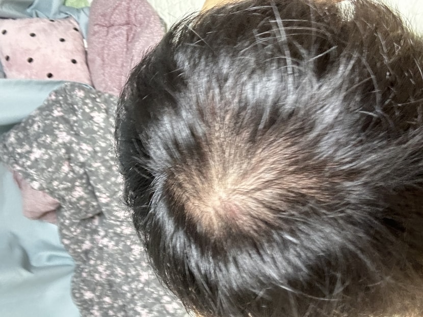 복용 일주일 전