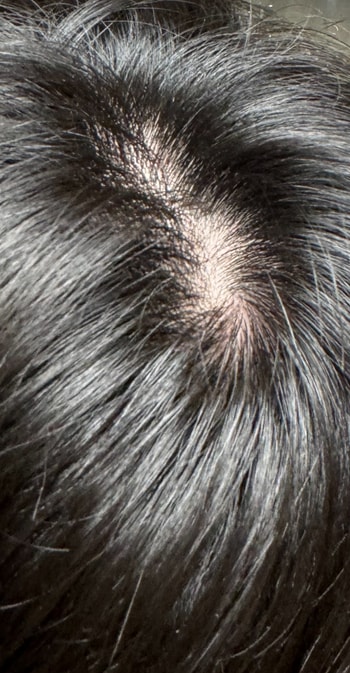 정수리쪽 빈공간