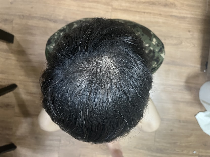 카메라 후레쉬 키기 전