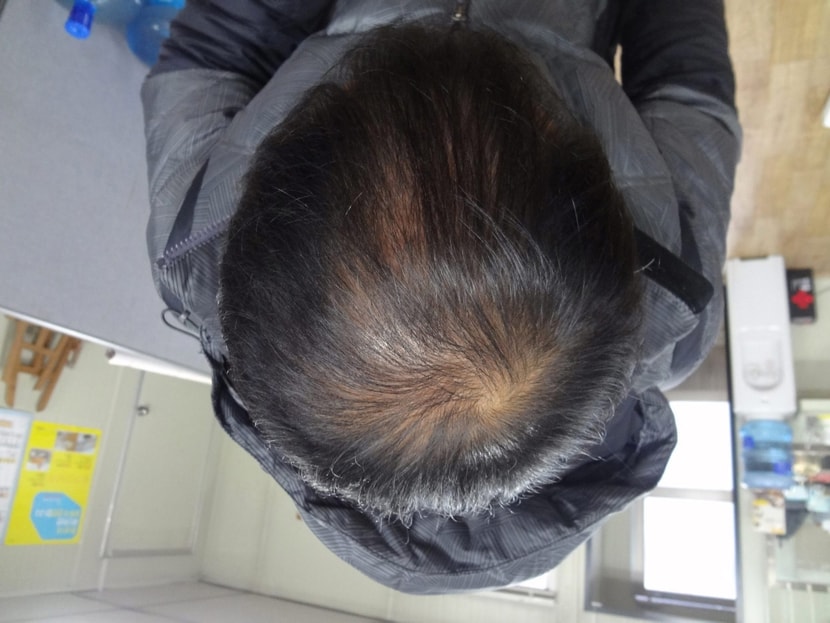 현재
