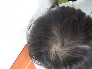 관리 약6달 + 어성초비누2달