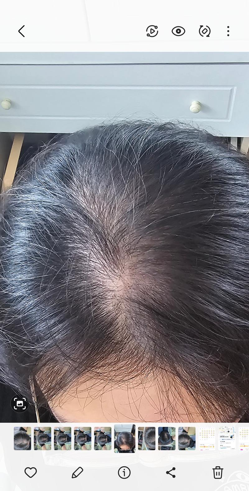吃的米诺丁已经没有效果了，想开始流血了《女人》