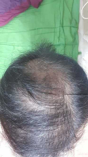 두타놀 50일