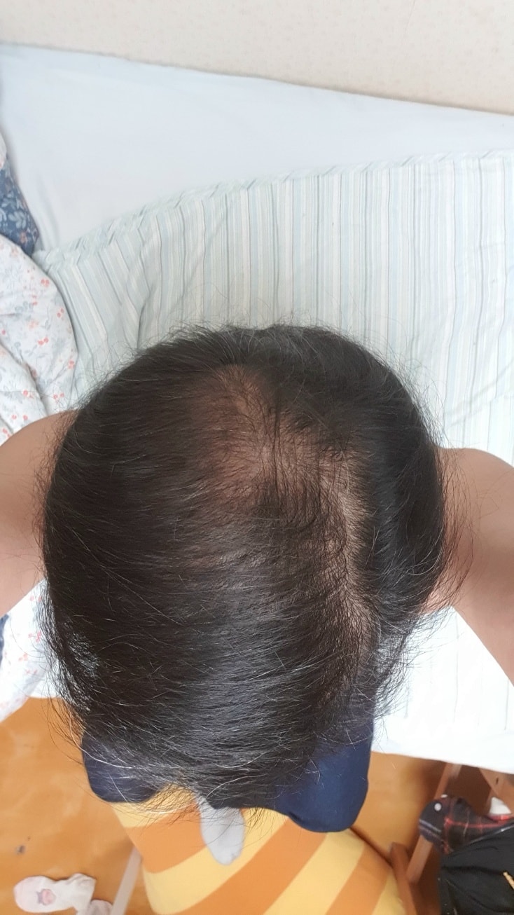 두타놀 100일