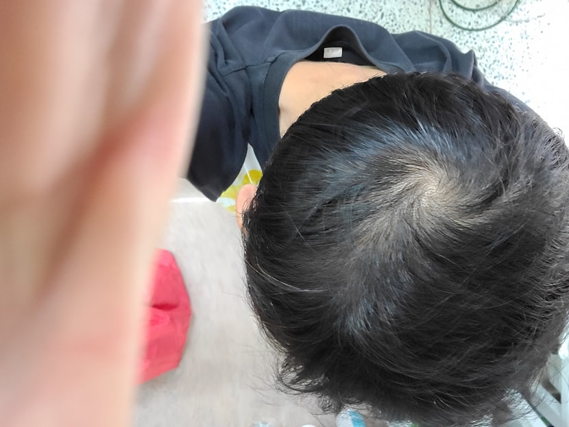 70일경과