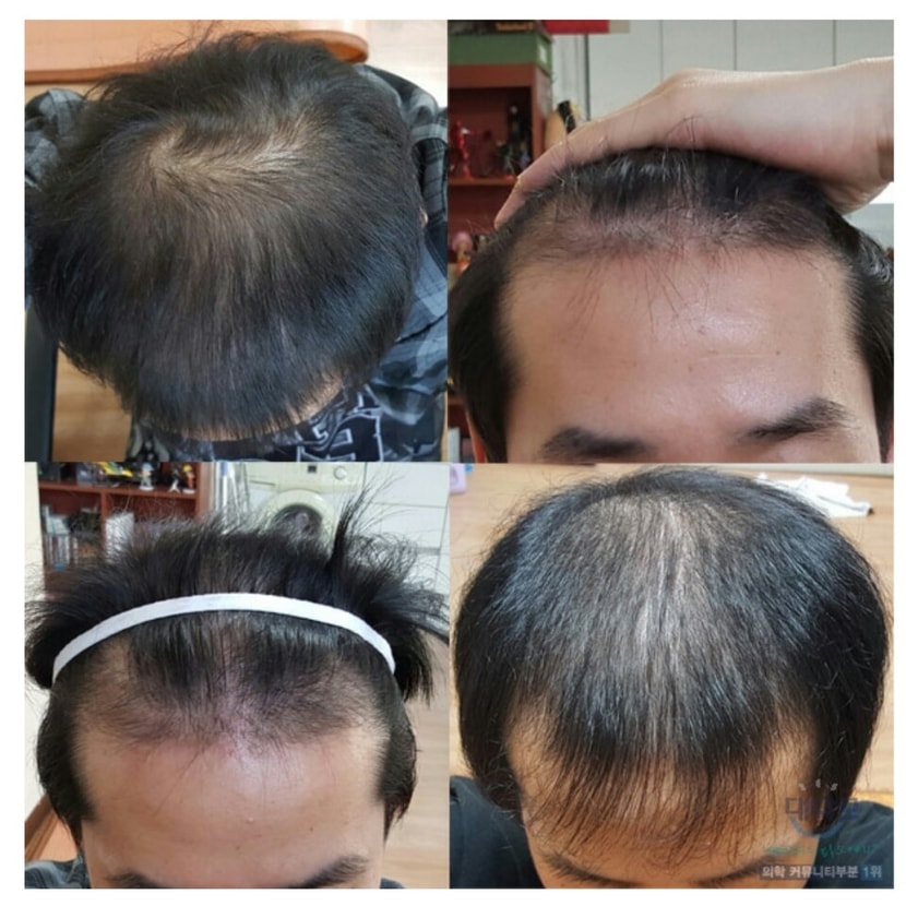 3개월전 전체모습...