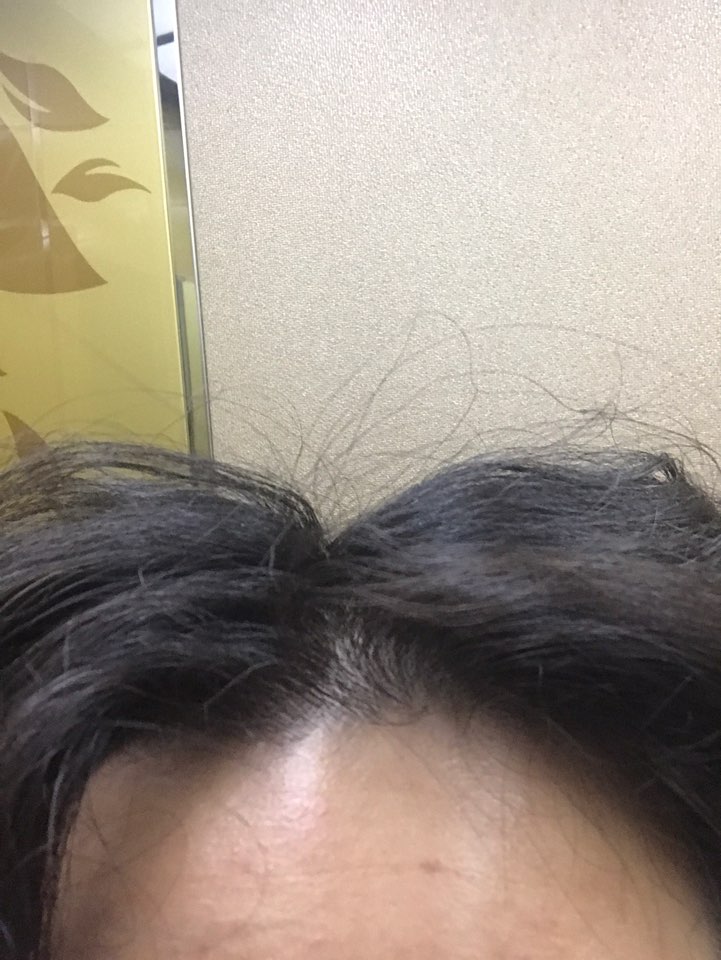 이게 오늘자... 똑같이 5대5 했을때