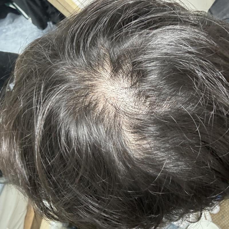 아보다트 1년후기