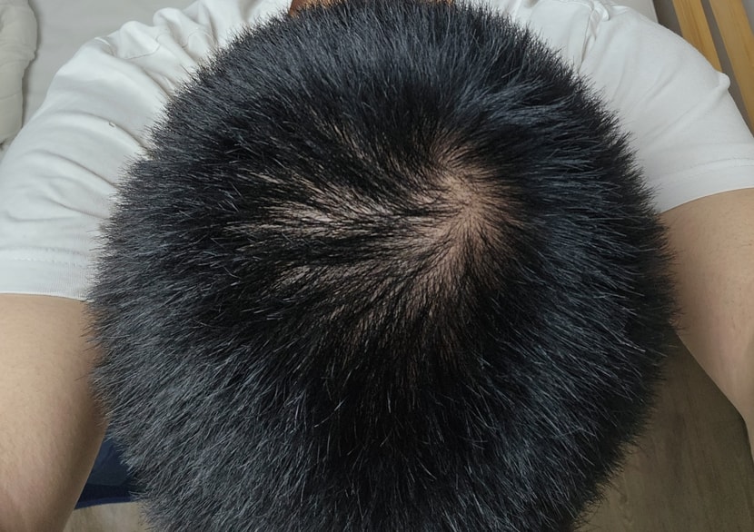 뭐 해야할까요
