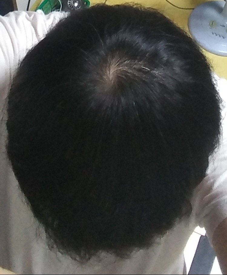 20180822