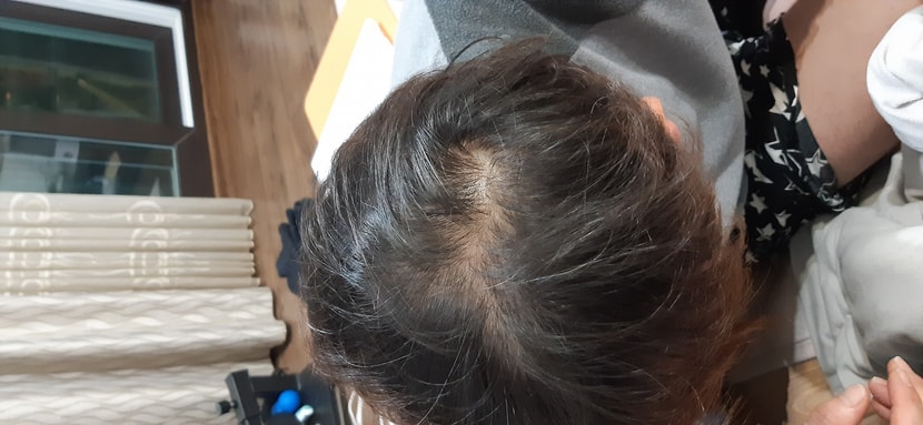 복용전 사진