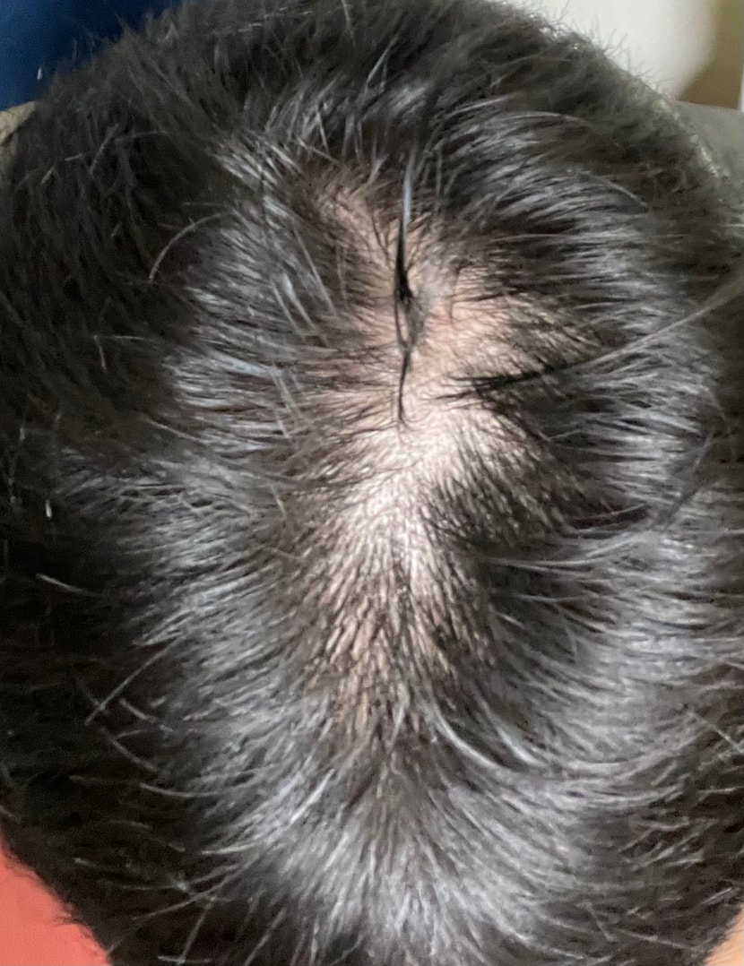 바로 위에 조명이 있는 곳에서 찍은 2개월차 때 사진입니다.