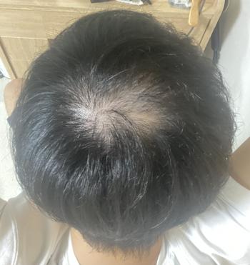 10일차