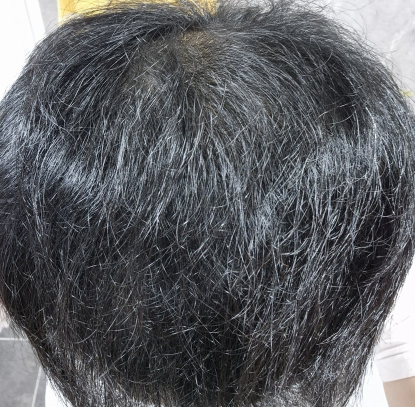 약 먹은지 65일 후