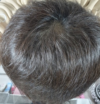 오늘 약 먹은지 4개월