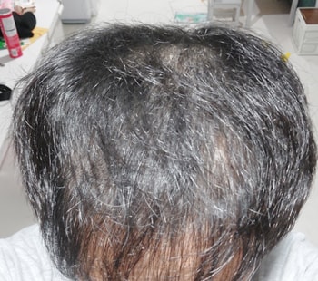 약 먹은지 25일 후