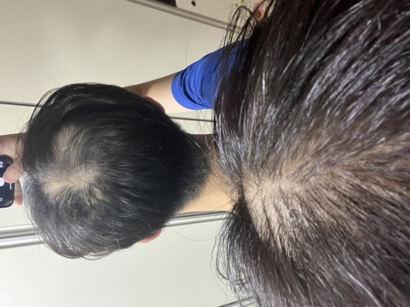 한달반만에 전체적으로 엄청 많이 빠졌어요..