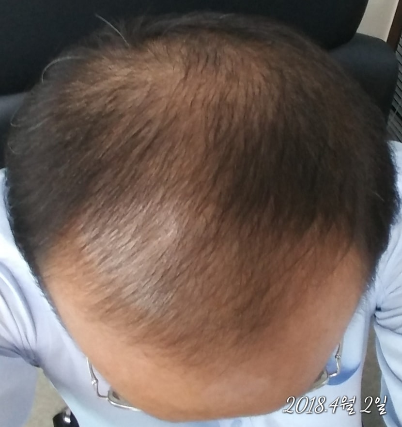 4월2일