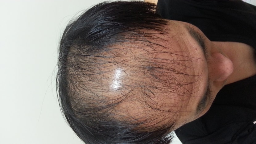 2015.12.14. 약복용 약26일차 딱히 특별한 변화 없음