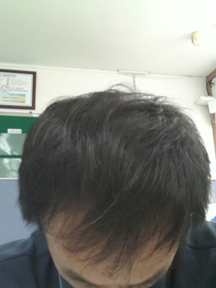 17년 9월 22개월차