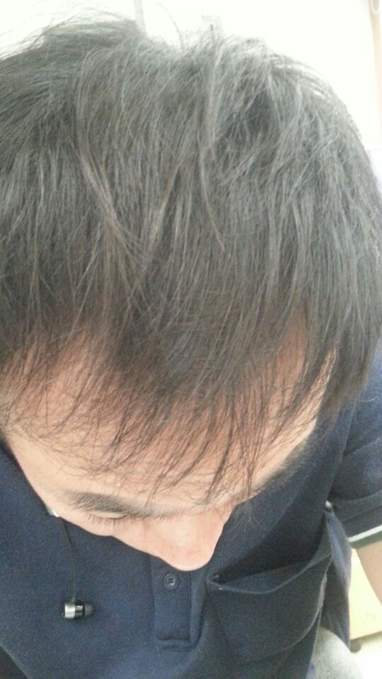 17년 9월 22개월차