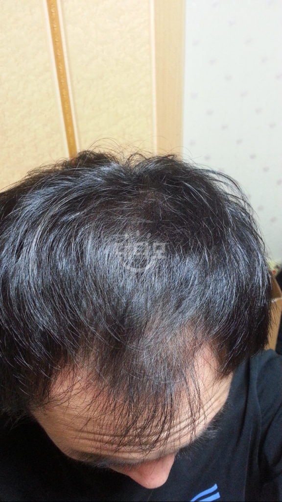 16년 5월 6개월차