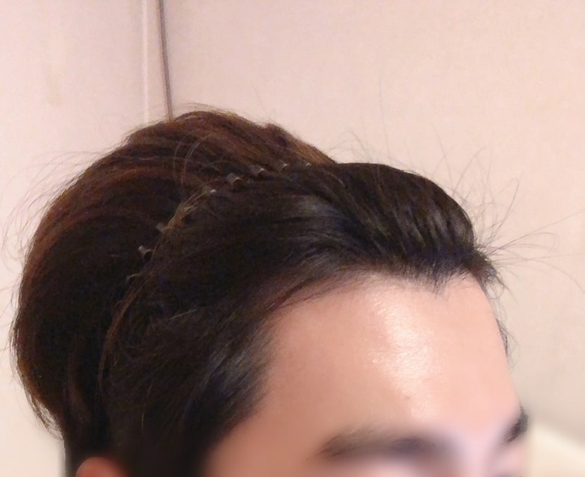 현상태2