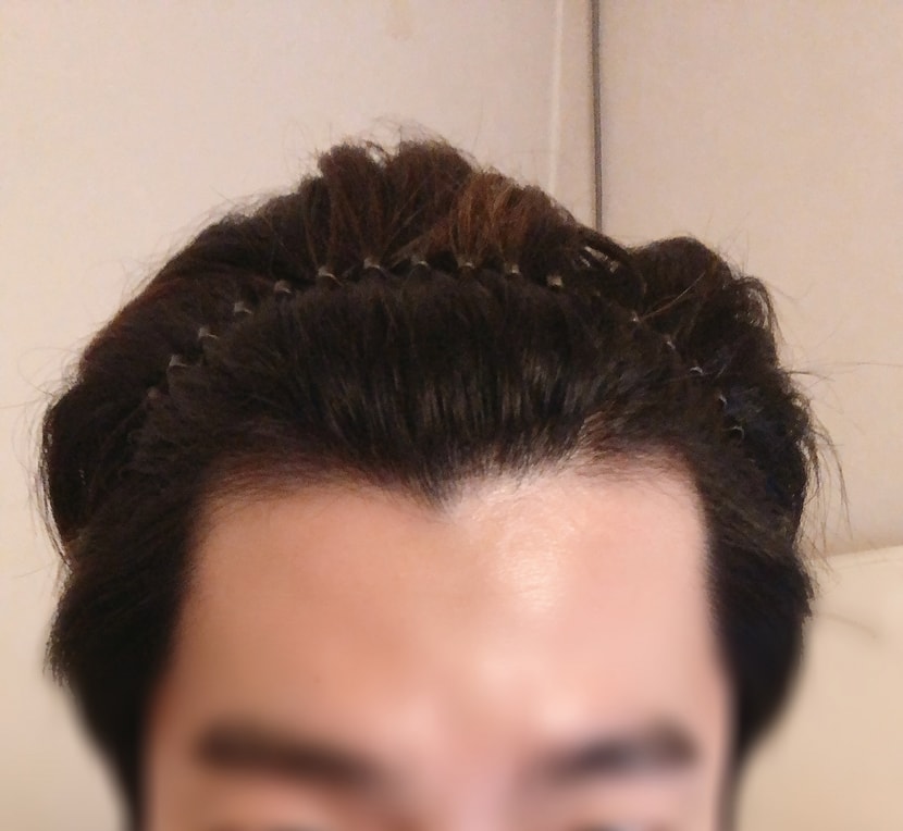 현상태
