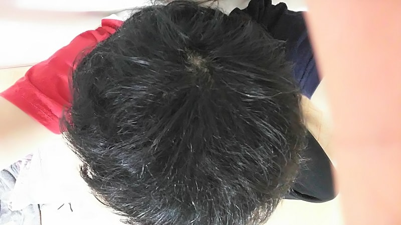 是第3个月的后期。