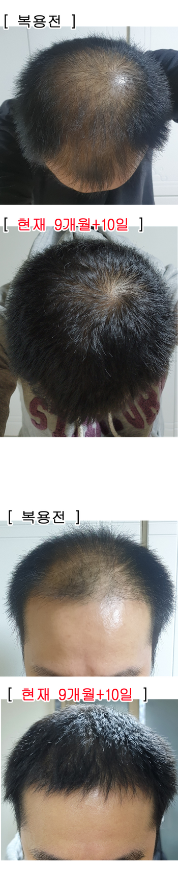 9개월