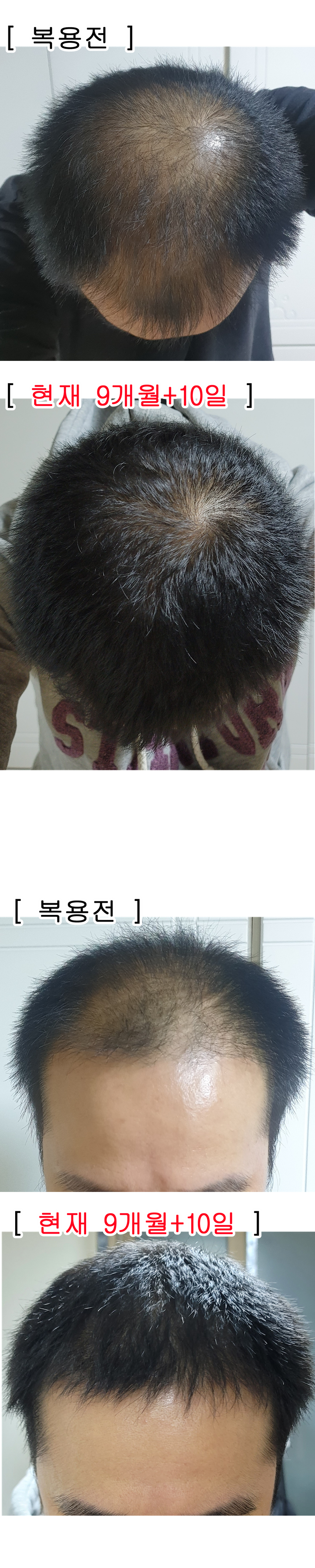 9개월