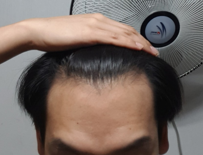 2020.10.15 (현재)