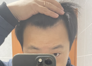 복용 후