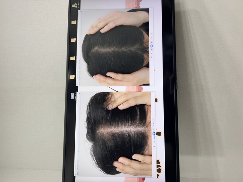 복합 처방 후기