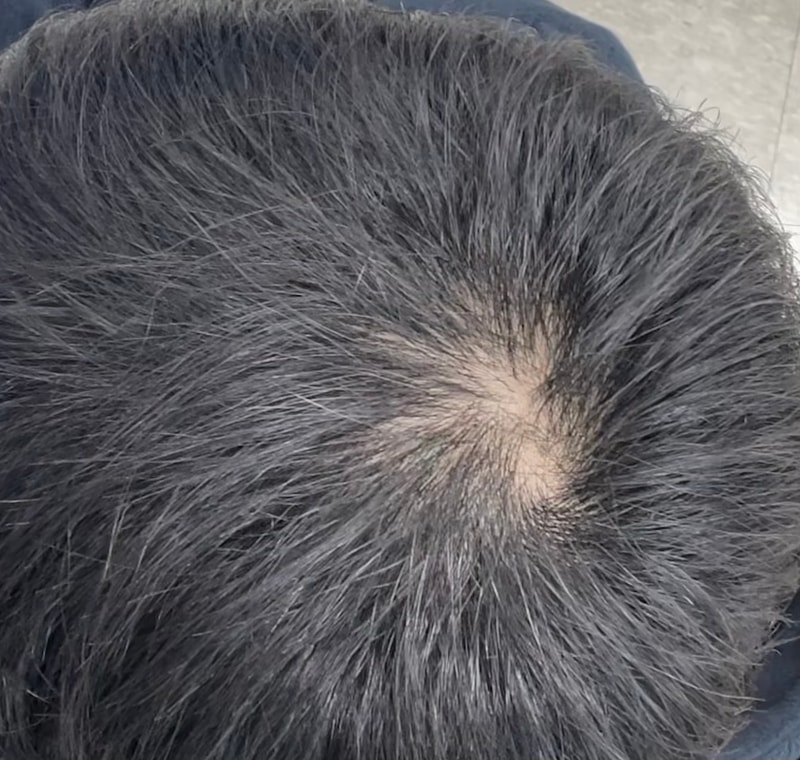 <평가글>피나온 1개월