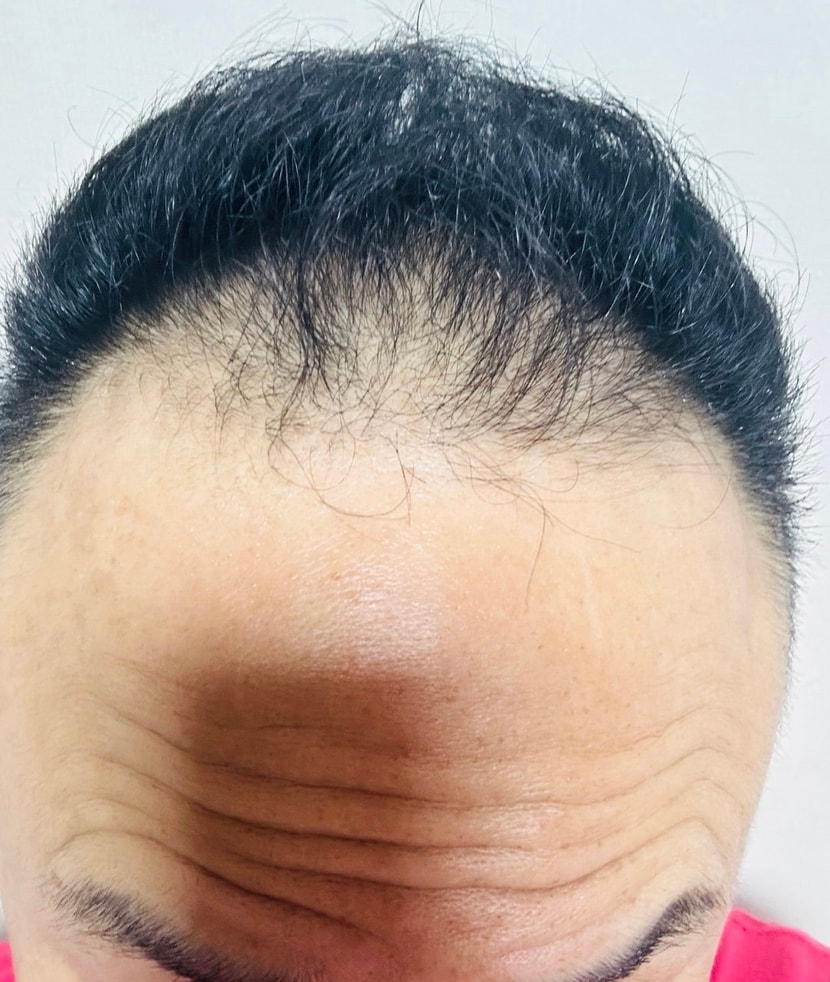 약먹기 직전