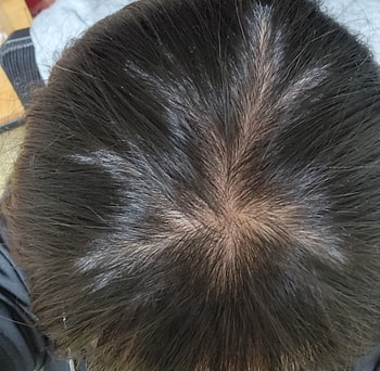 일주일후