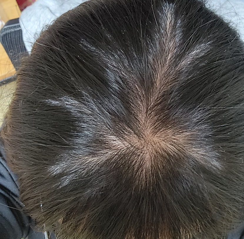 일주일후