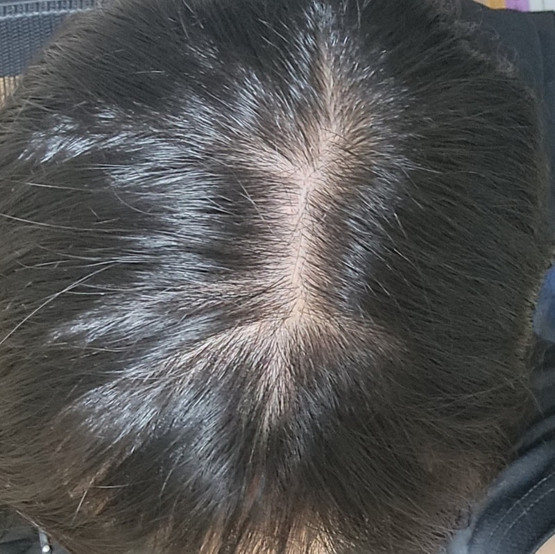 미녹정 일주일 먹은 후기