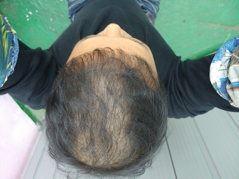 약먹고한달쯤