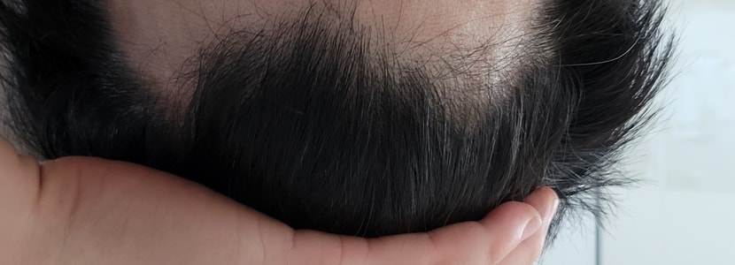 35일차 헤어라인