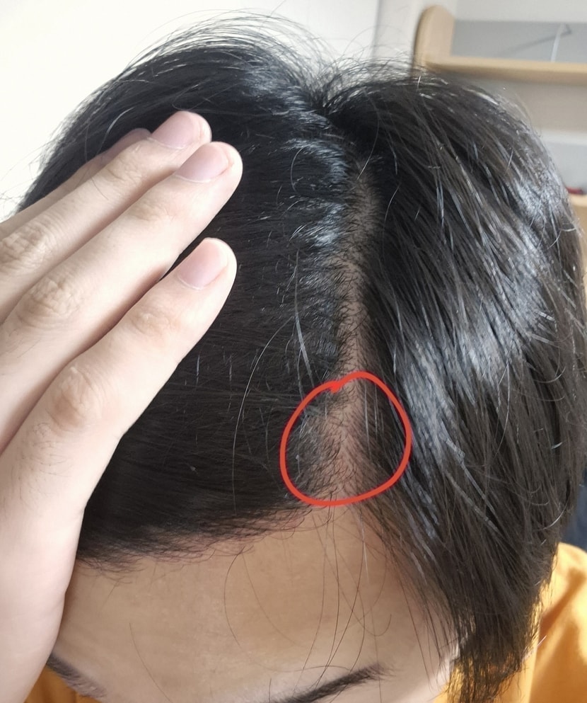 동그라미 부분은 심은부위