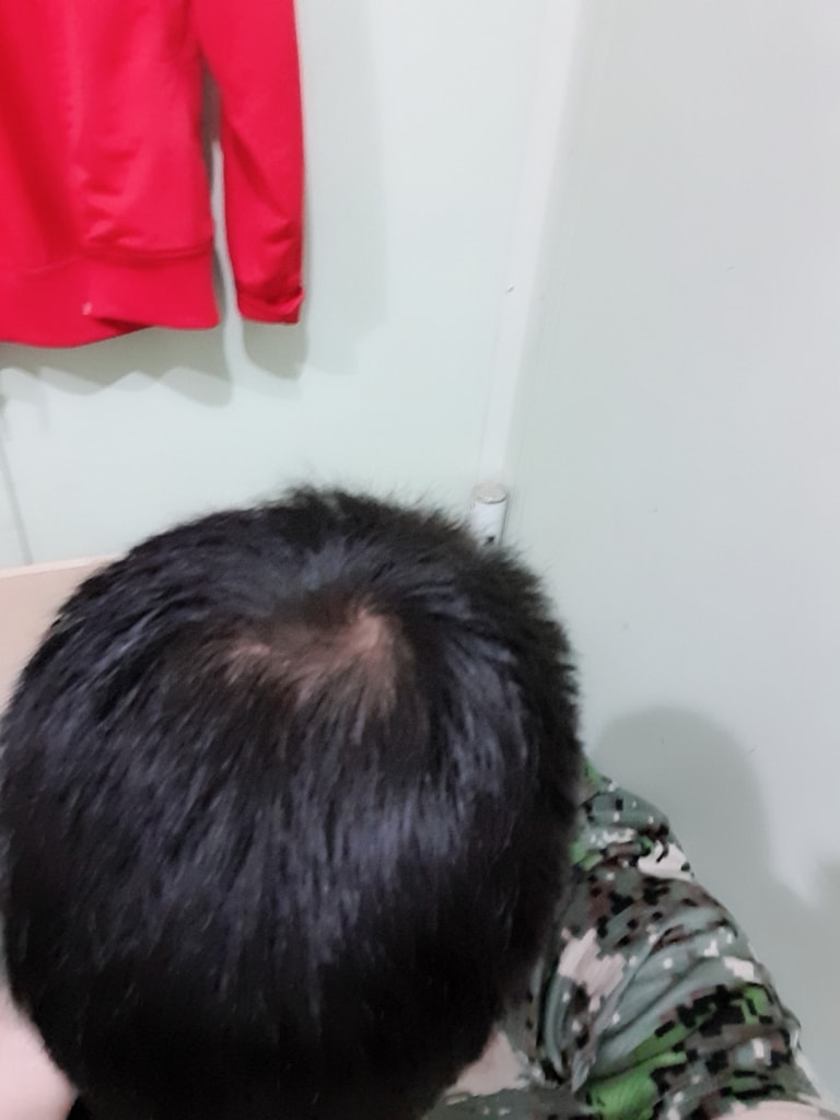 지금 현재상태입니다!