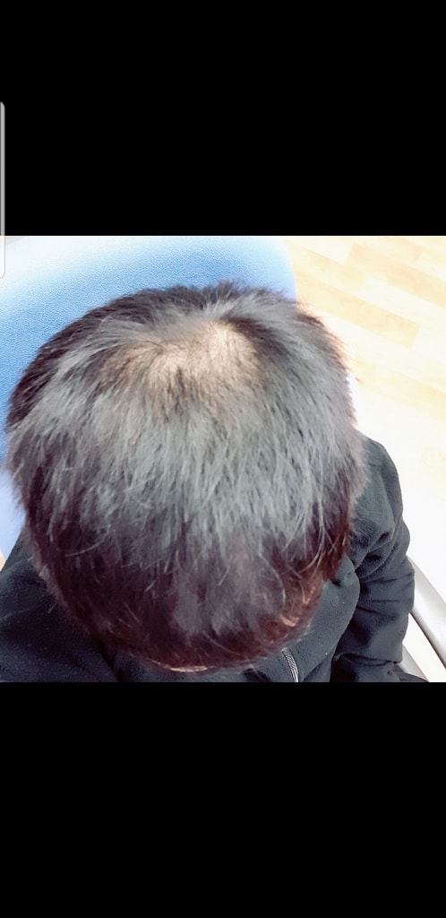 처음 먹기시작한 1월 중순입니다!