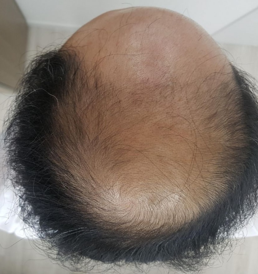 시작한지 일주일정도