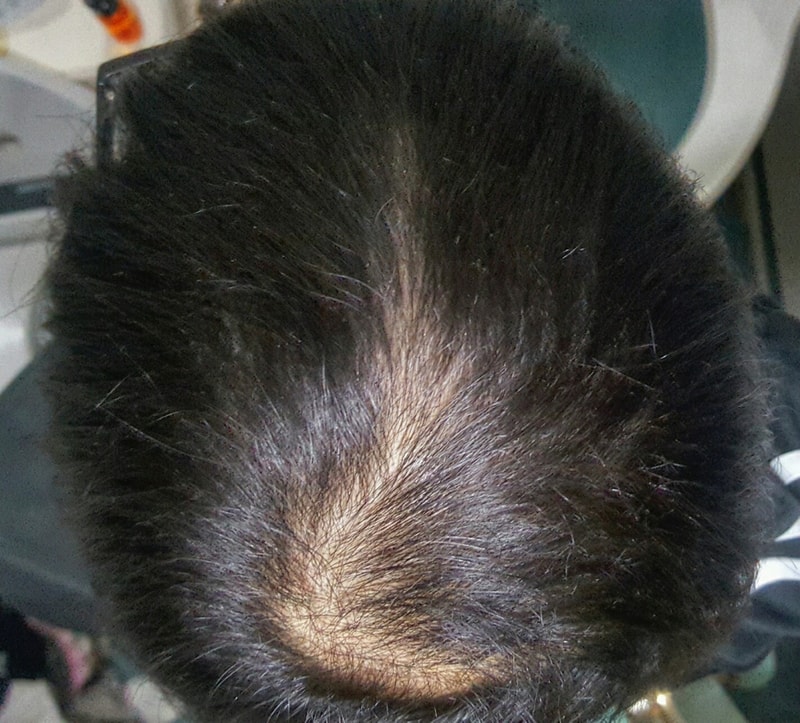 미노페시아 7개월