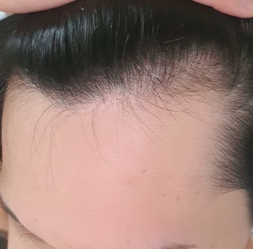 오른쪽 